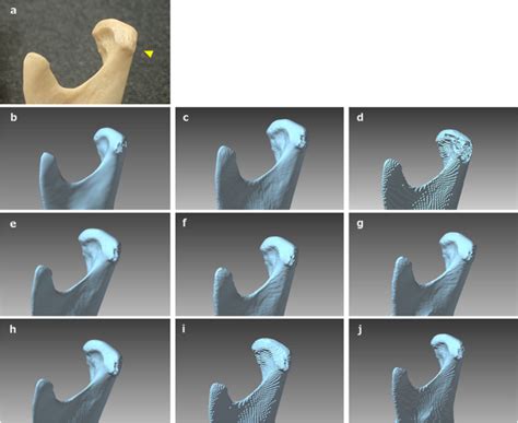 stl meaning medical|DICOM segmentation and STL creation for 3D printing: a process .